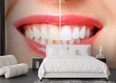 woman teeth before and after whitening. Over white background Wall mural