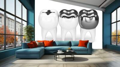 3d render of teeth with different types of dental amalgam filling Wall mural