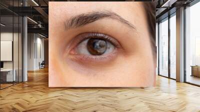 A macro view of a cloudy cataract in the eye of a young woman with a brown iris. Symptom of aging, trauma and smoking tobacco. Wall mural