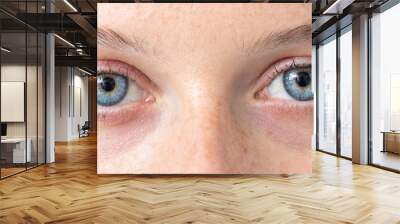 Blue eye of young caucasian woman Wall mural