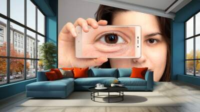 Girl showing the magnified image of eye bag through her smart phone Wall mural