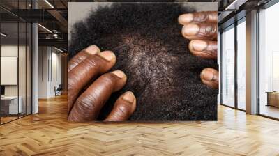 Thin hair loss on afro-american man scalp Wall mural