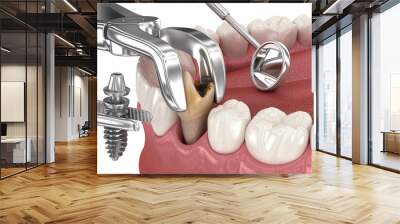 Extraction and Implantation, complex immediate surgery. Medically accurate 3D illustration of dental treatment Wall mural