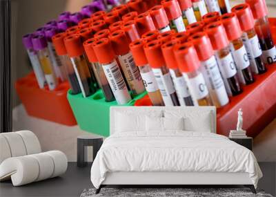 Medical test-tube with blood samples Wall mural