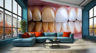 Side-by-side teeth comparison illustrating the whitening process, showcasing significant stain reduction, high contrast, Realistic, Minimalist Background Wall mural