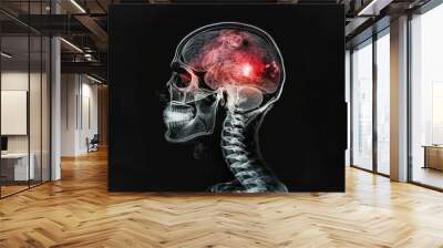 X-ray of a man. Brain damage Wall mural