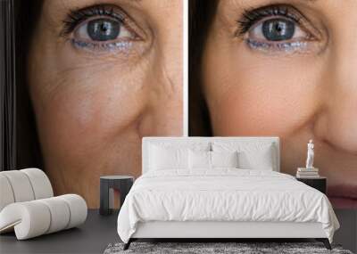 Anti Rejuvenation Wrinkles Lift Before Wall mural