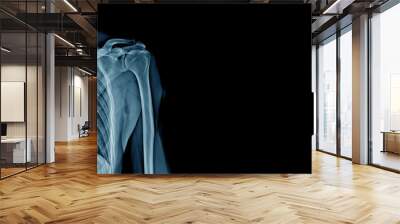 x-ray shoulder and part of rib and lung, banner x-ray Wall mural