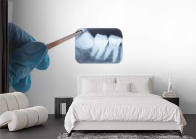 gloved dentist surgeon holds x-ray of lower retarded wisdom tooth. Film noise effect Wall mural