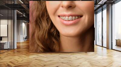 Closeup shot of pretty female smile with dental braces Wall mural