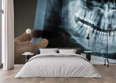 Hand is visible holding an x-ray dental scan of a person with braces on teeth, with visible traces of moving teeth, like bent roots. Two upper teeth are missing. Wall mural