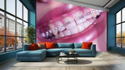 A closeup showcases a radiant smile featuring clear braces on perfectly straight teeth with glossy, pink lips in a bright environment Wall mural