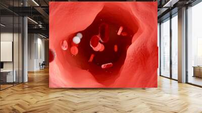 Vascular walls at a moderate stage of atherosclerosis. Cholesterol plaques on the walls of blood vessels. Narrowing of a blood vessel. 3d rendering Wall mural