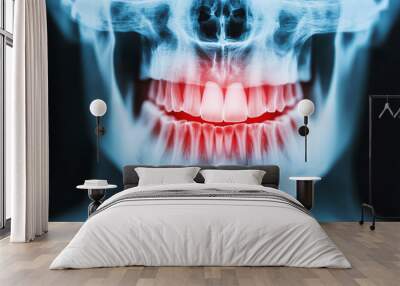 X-ray image of a human skull showing teeth with highlighted areas, illustrating dental health and anatomy in a striking visual representation. Wall mural