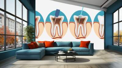 Root canal process Wall mural