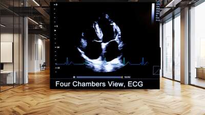 Colourful image of homan heart ultrasound monitor Wall mural