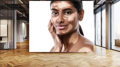 Beautiful South Asian woman with vitiligo skin disorder against white background Wall mural