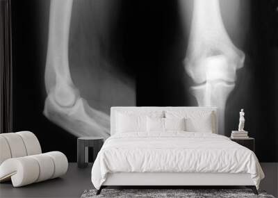 Elbow xray Wall mural