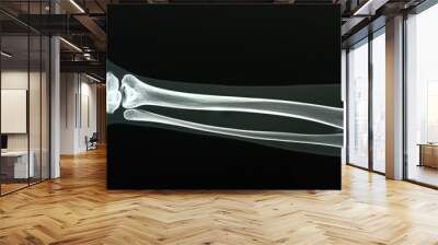 X-ray of an arm Wall mural