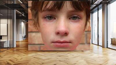 Portrait of an upset child with red blotchy skin and big green eyes Wall mural