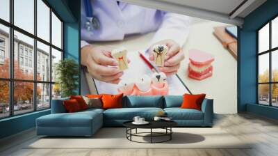 Dentures, dentures in the jaw, root canal treatment, gum disease, tooth models for dentists who are studying dentistry. Wall mural