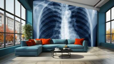 chest x-ray of normal healthy man show lung, heart, spine, clavicle, diaphragm Wall mural