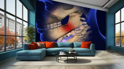 Broken Jaw joint with Metal Plate and Screws Wall mural