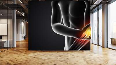 Human having pain in Arm	 Wall mural