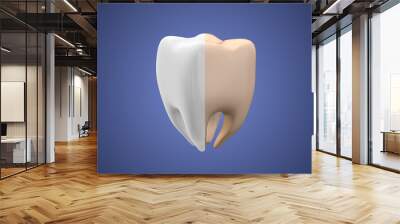 Medical animation of the healthy and yellow tooth Wall mural