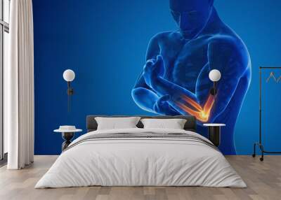 Pain in the elbow joint Wall mural