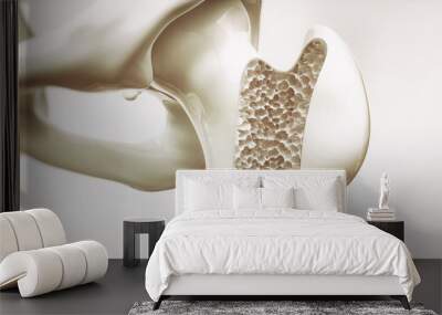 Osteoporosis stage 4 of 4 - upper limb bone - 3d rendering Wall mural