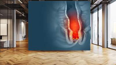 Haemorrhoids (piles) on scientific background. Virus infection. 3d illustration Wall mural