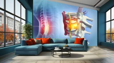 Human spinal cord injury, back pain on blurred background. 3d illustration Wall mural