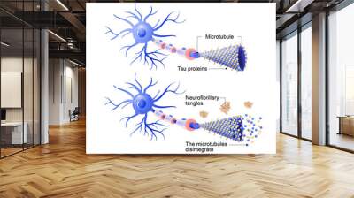 healthy cell and neurons with Alzheimer's disease. Tau hypothesis Wall mural