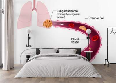 Metastasis. Metastases Wall mural