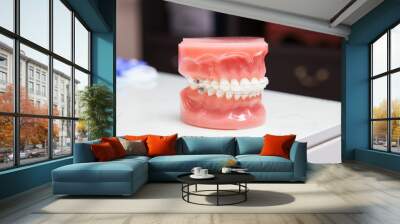 Dentist demonstration teeth model of varities of orthodontic bracket or brace with flesh pink gums Wall mural