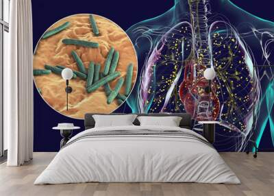 Human lungs affected by miliary tuberculosis, with a close-up view of the Mycobacterium tuberculosis bacteria, 3D illustration Wall mural