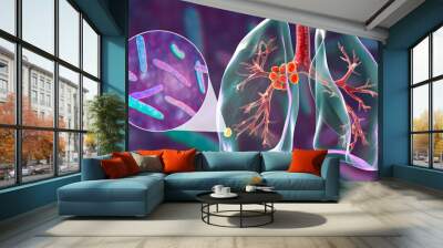 Primary lung tuberculosis, 3D illustration Wall mural