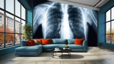 Xray of a human torax Wall mural