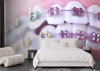 Cosmetic dental metal brackets Wall mural