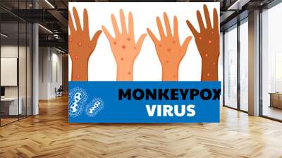 Monkeypox virus poster. Web banner of monkey pox skin infection of person. Vector Illustration. Wall mural