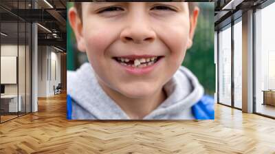 The baby boy smiling with wobbly milk tooth in open mouth. First molar teeth.  Wall mural