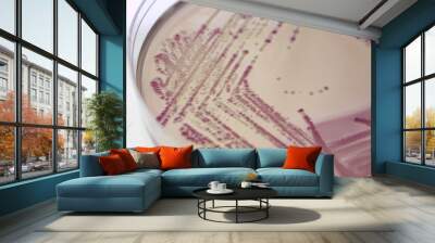 bacterial colonies Wall mural