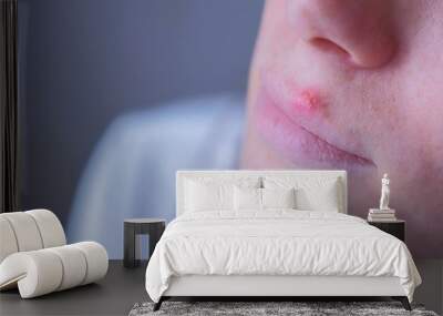 Herpes virus on human lips. Woman with herpes sore on lip mouth, closeup view. Process of dehydration during illness. Human papilloma virus, viral infection. Wall mural