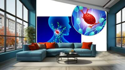 Swollen Lymph Node as an infected gland of the Lymphatic system and immune system as a swelling of the lymphoid organ infected by bacteria or virus. Wall mural