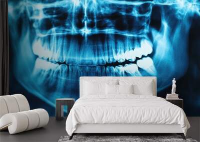 Panoramic dental x-ray showing healthy human teeth Wall mural