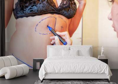 surgeon preparing woman for liposuction surgery Wall mural