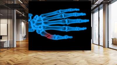 X-ray hand Wall mural