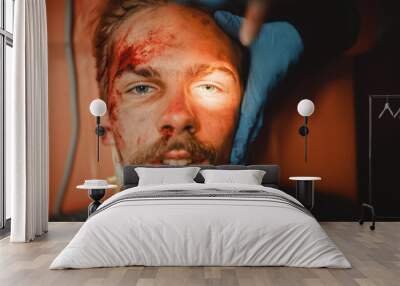 Intense Portrait of an Injured Young Male Patient with Blood Bruising on His Face. Injured Man with a Beard Looking at Camera while Lying on a Hospital Stretcher. He's Happy to be Alive. Wall mural