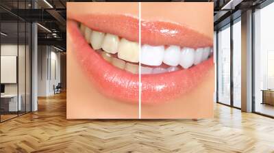 teeth whitening Wall mural